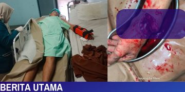 Rusdianto Dibacok Tetangganya di Bengkong Laut