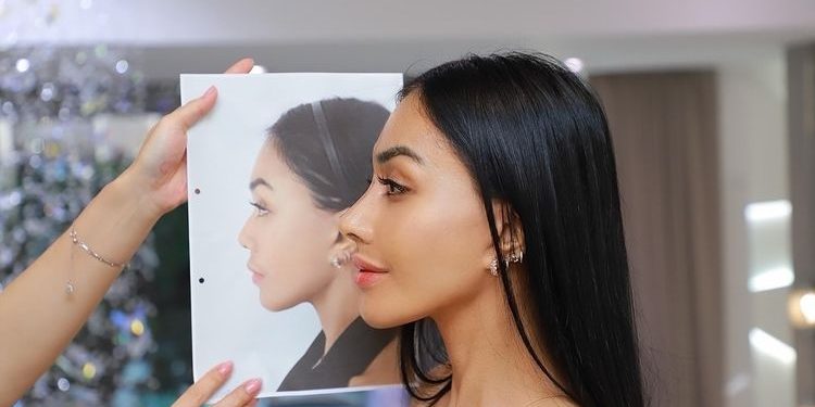 Denada Dituding Telantarkan Anak, Manajemen Minta Privasi Dihormati