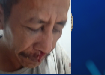 Sopir Lori Dianiaya Petugas Bea Cukai Telaga Punggur