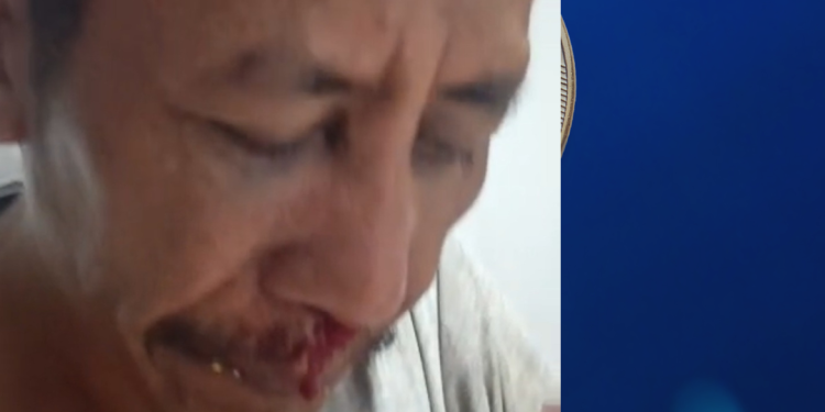 Sopir Lori Dianiaya Petugas Bea Cukai Telaga Punggur